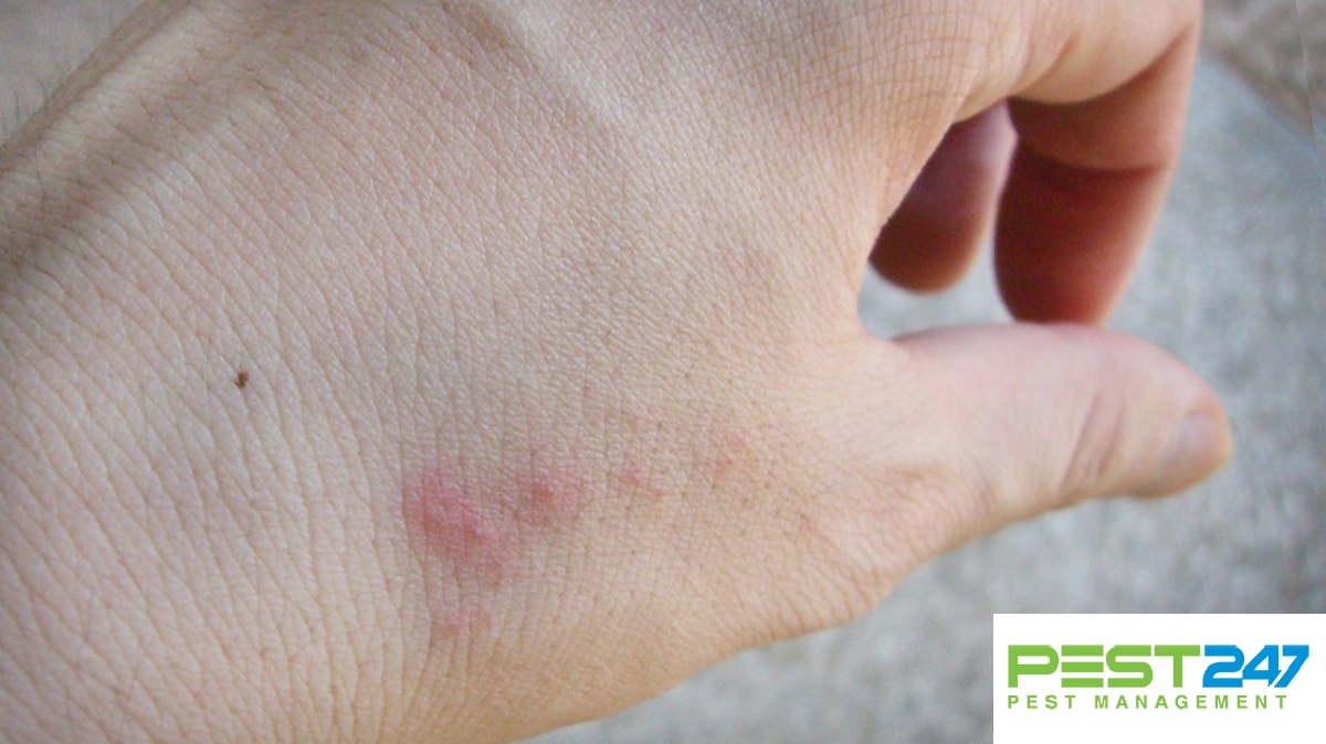 " Rệp giường: Cách nhận biết rệp và cách diệt tận gốc loại rệp này"