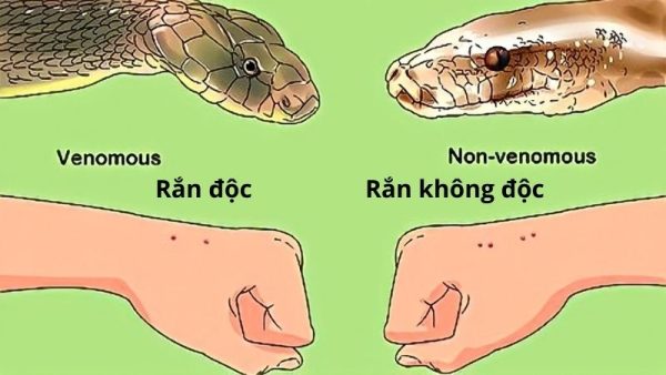 Dấu hiệu nhận biết rắn xuất hiện – Cần làm gì khi bị rắn cắn